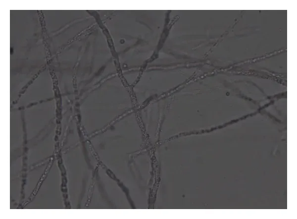 Mortierella alpina mycelium under a light microscope