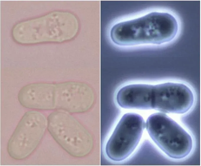 Microscope images of Schizosaccharomyces pombe cells at different stages of division