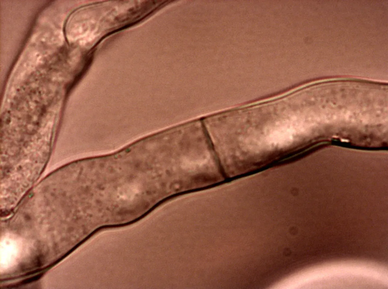 Micrograph of Neurospora crassa hyphae with visible septa.
