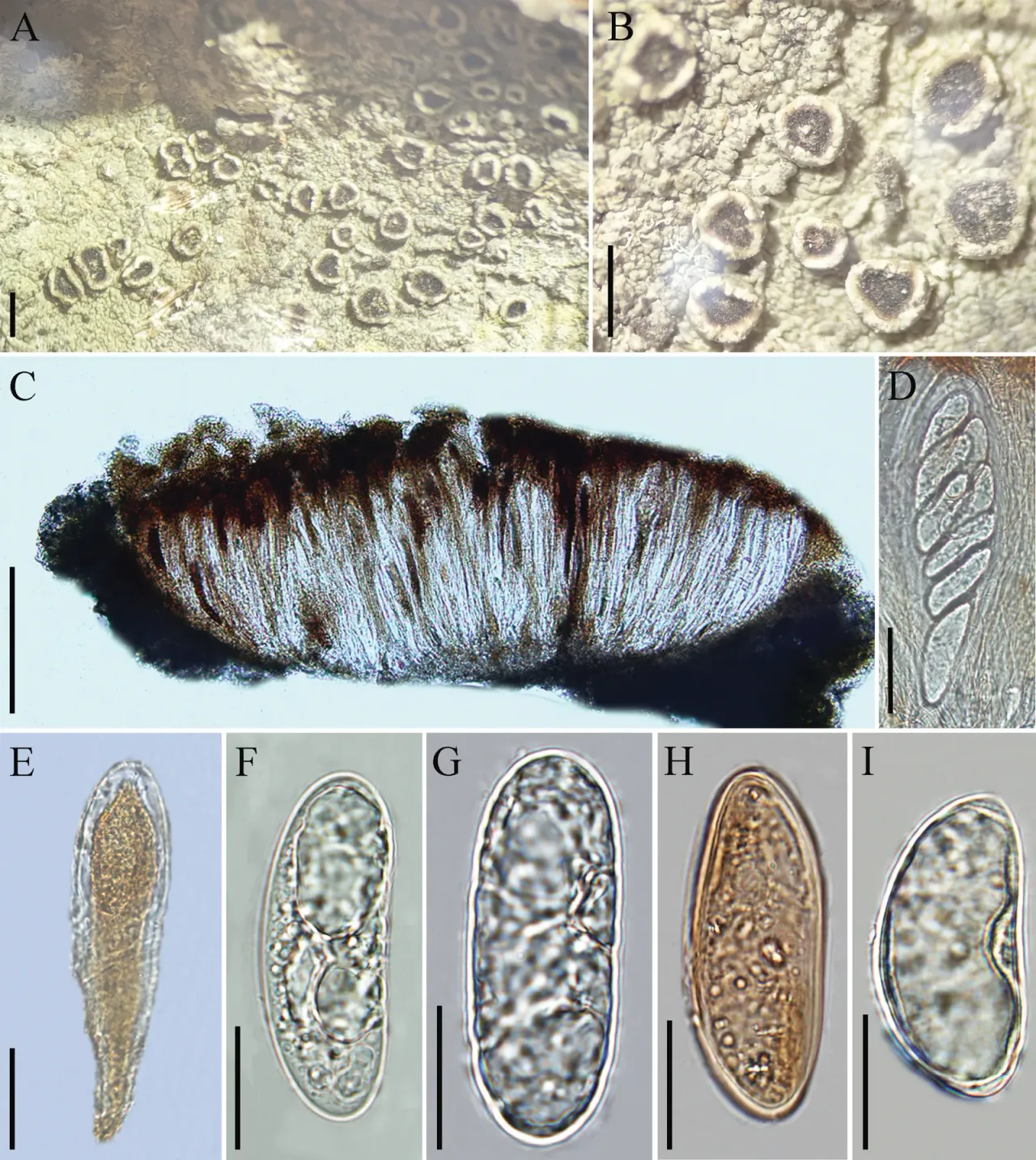 Complete figure of the Chicitaea yueliangshanensis holotype including microscopic characters