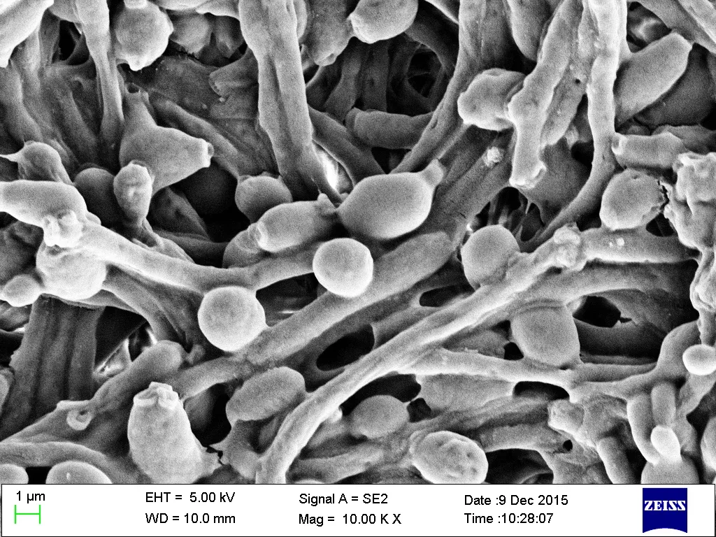 Komórki Candida albicans w skaningowym mikroskopie elektronowym