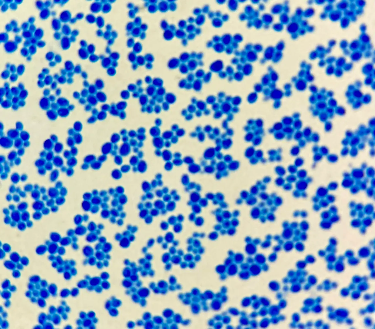 The yeast genome is sequenced