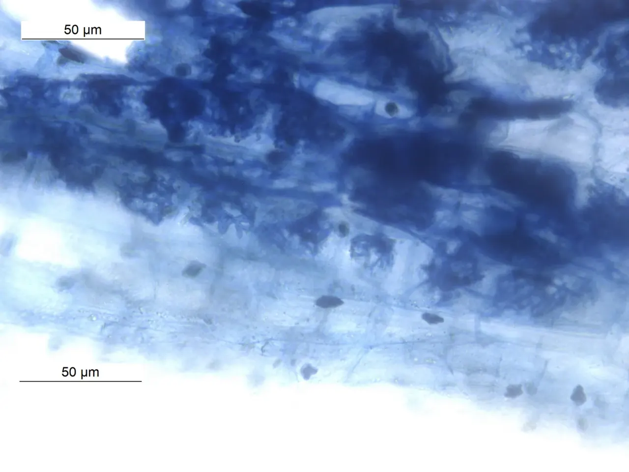 Global map estimates mycorrhizal hyphae in soil