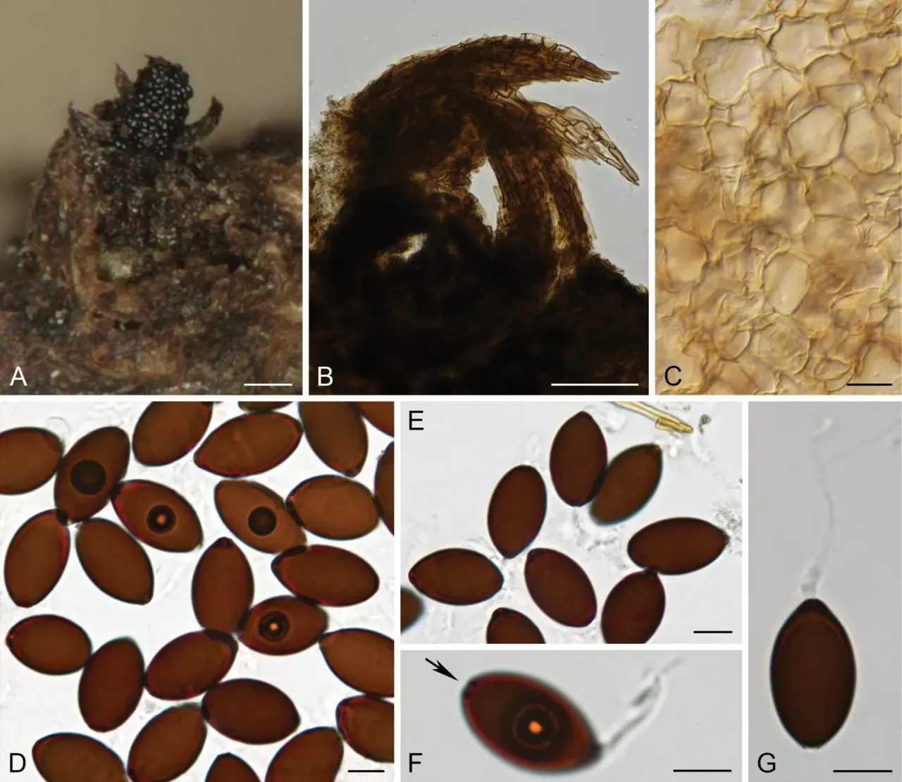 Schizothecium keniense — a new fungus from cow dung