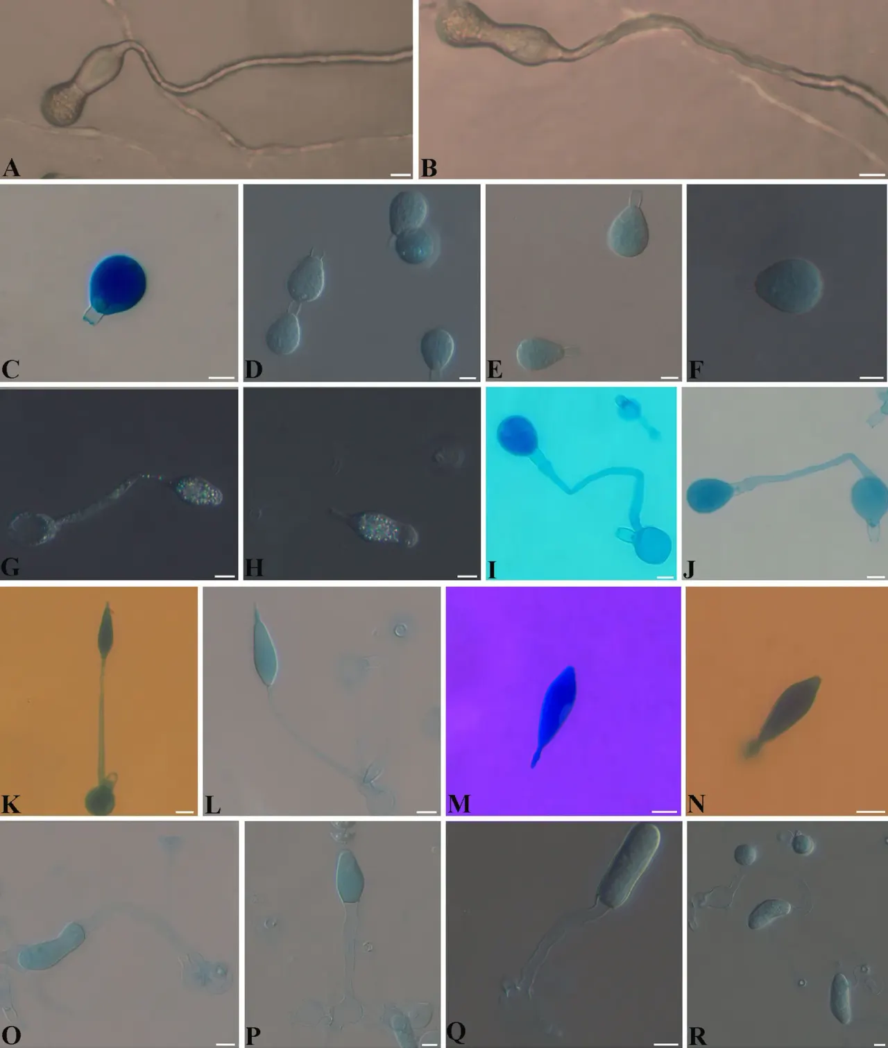 Drechslerosporium cornellii — a new genus