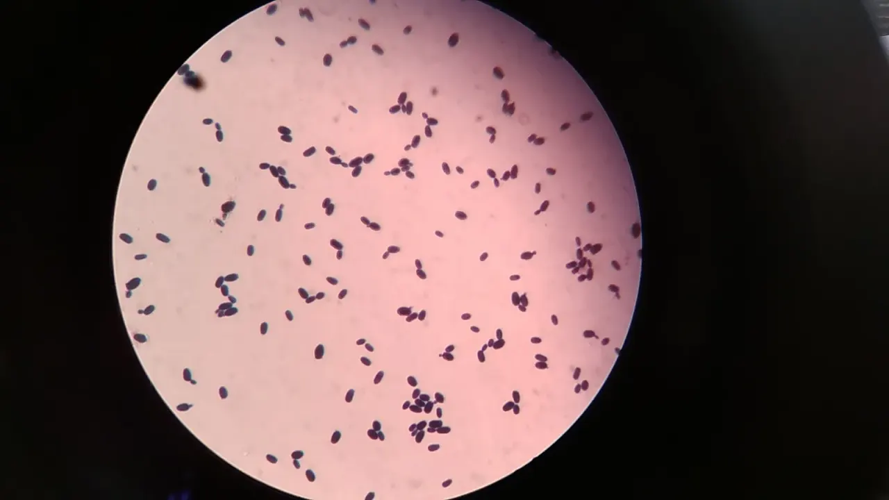 Fungi are closer to animals than to plants