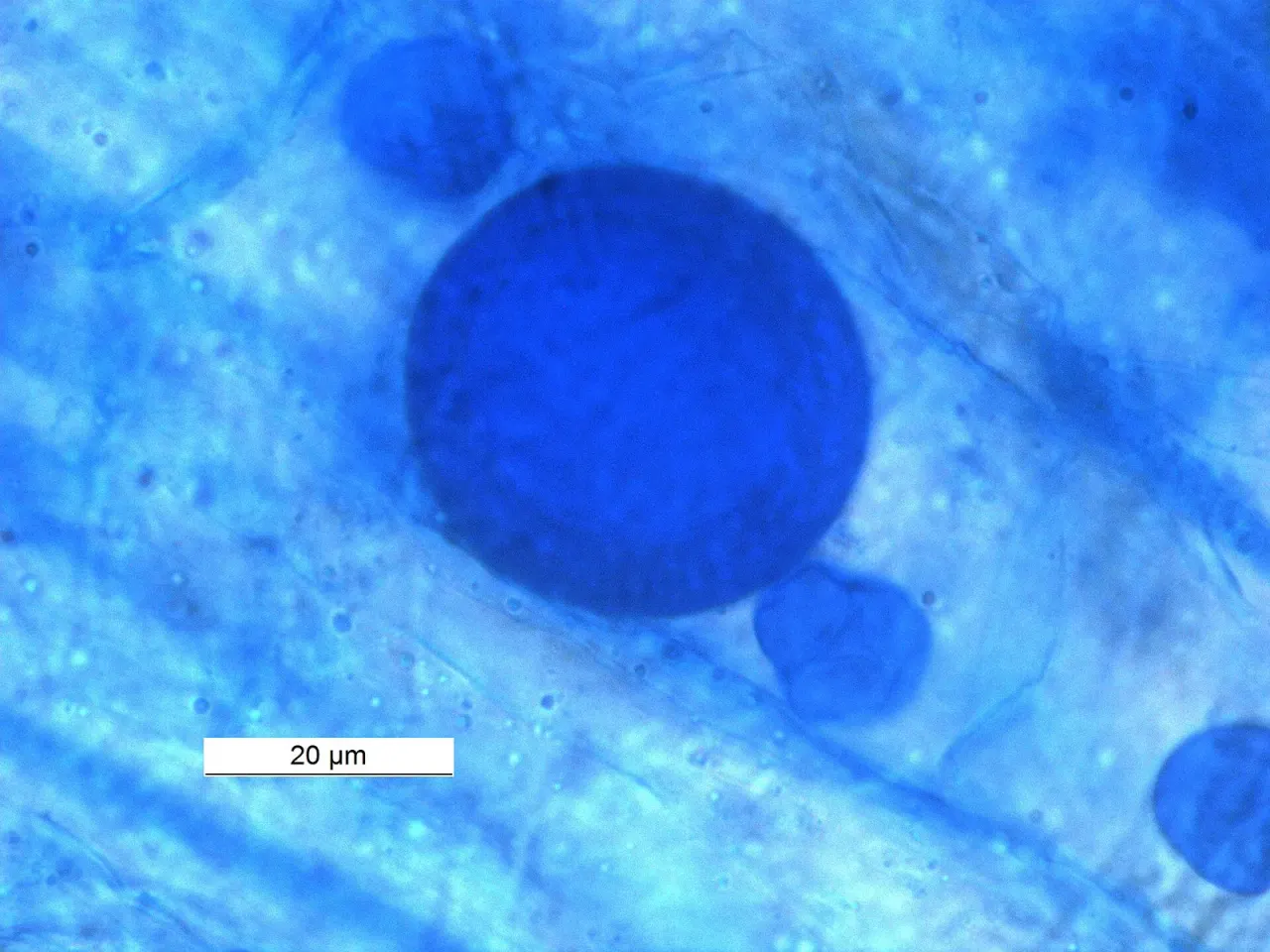 A new genus among arbuscular mycorrhizal fungi