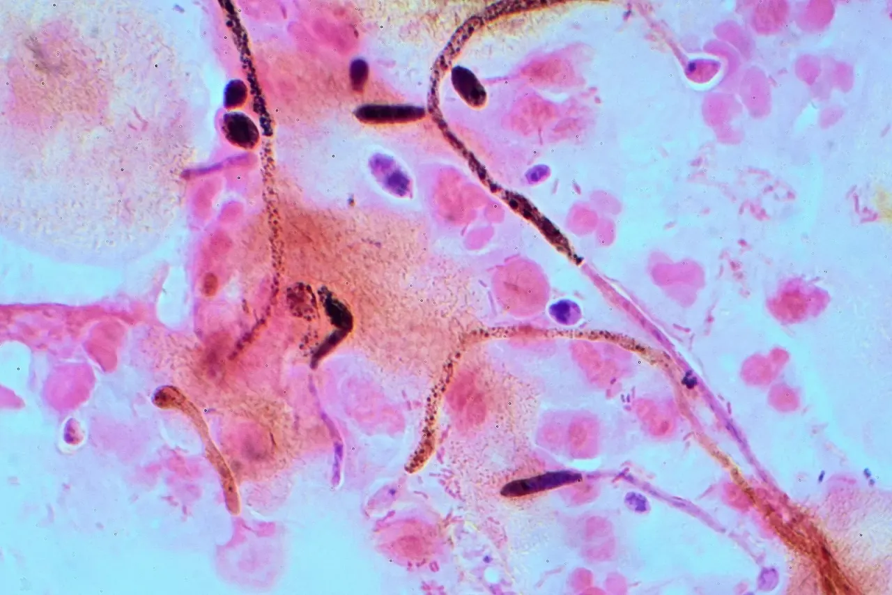A bacterial metabolite turns Candida from hypha back to yeast