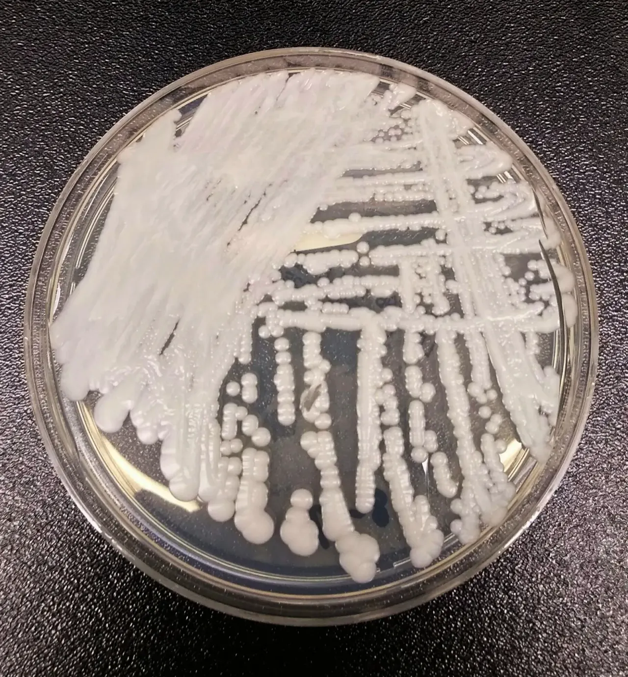 Candida auris exposes chitin to stay in the hair follicle