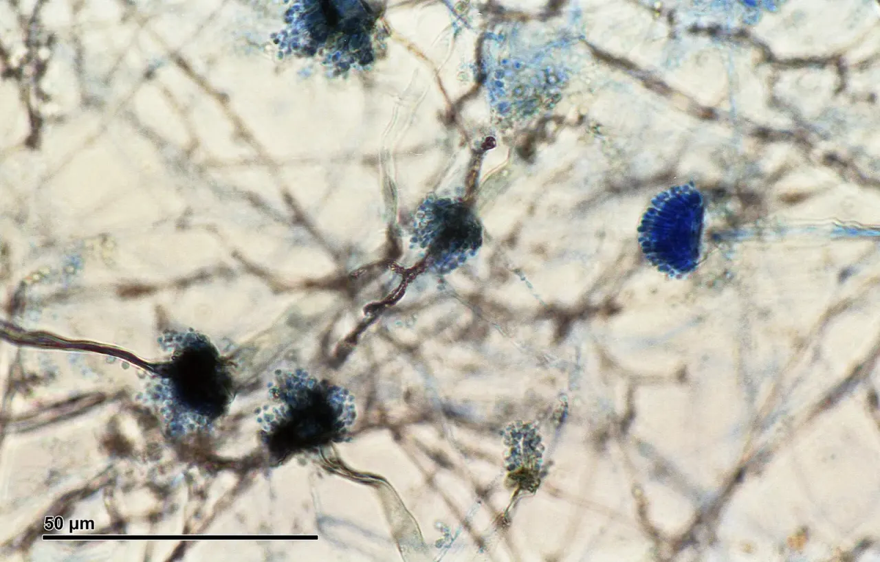 Field fungicides leave a reservoir of resistant fungi in the soil