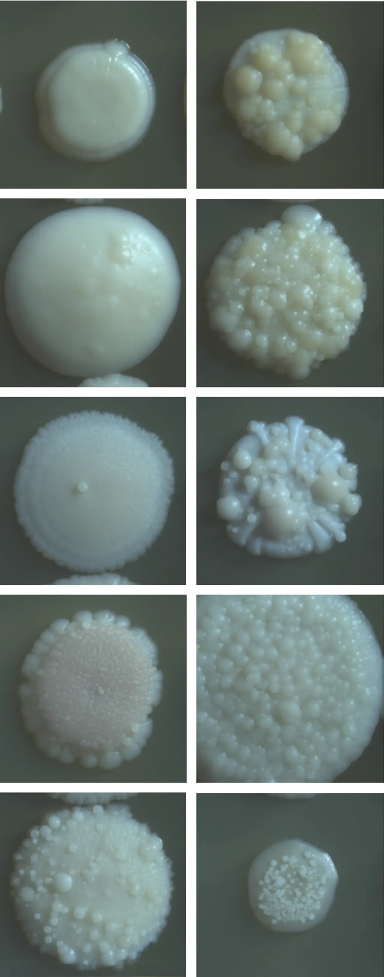 Candida starves the macrophage of sugar