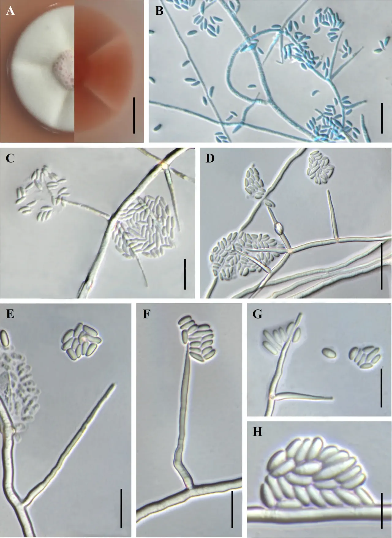 Ascopolyporus sinensis on an insect-killing fungus